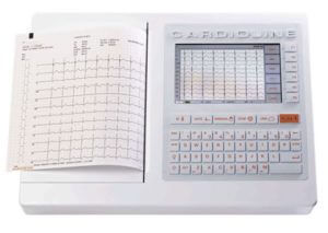 Electrocardiograma